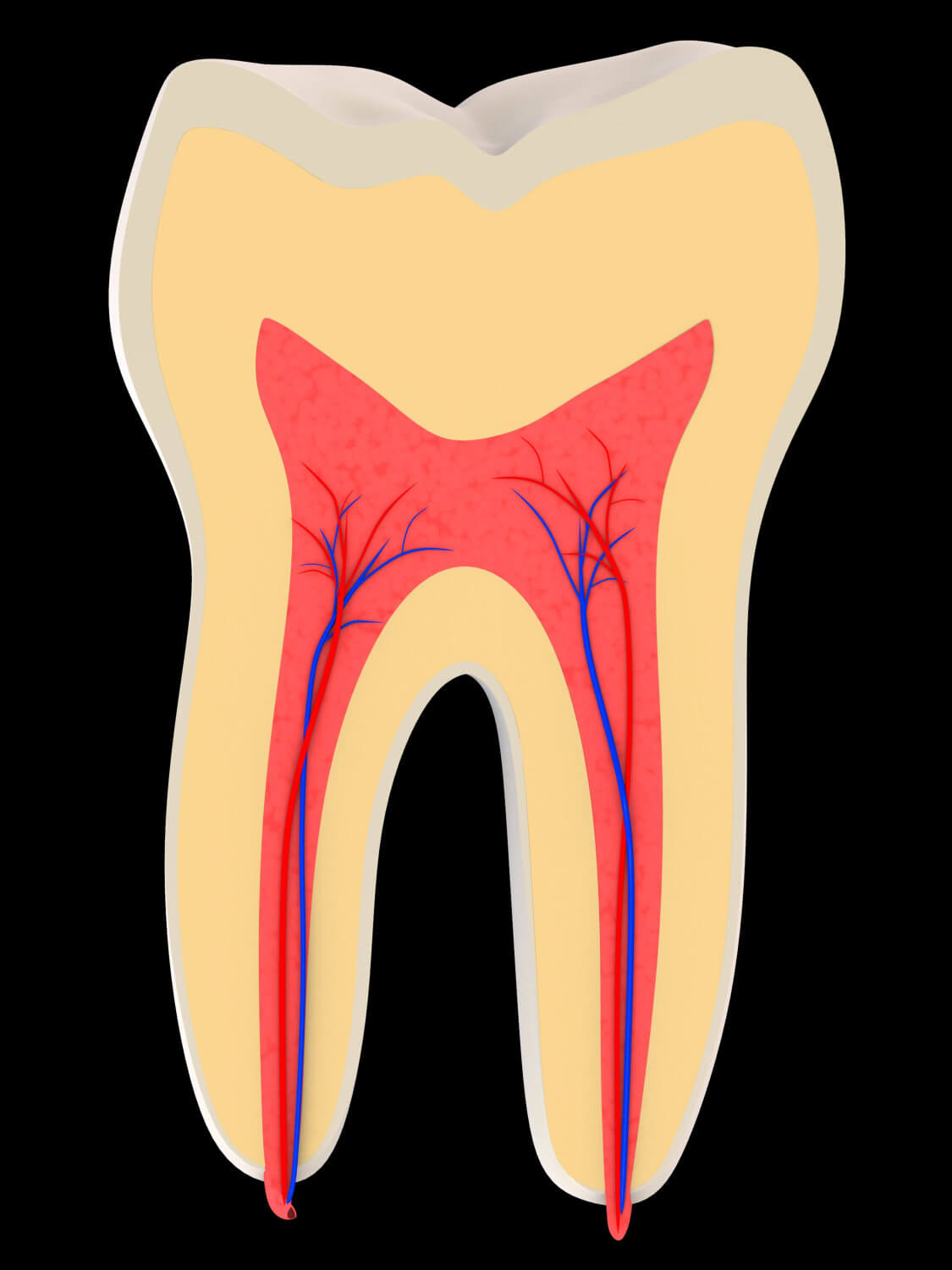 Downtown Dental,root canal